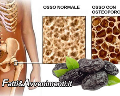 Salute & Benessere. Osteoporosi: un aiuto dalle prugne secche?