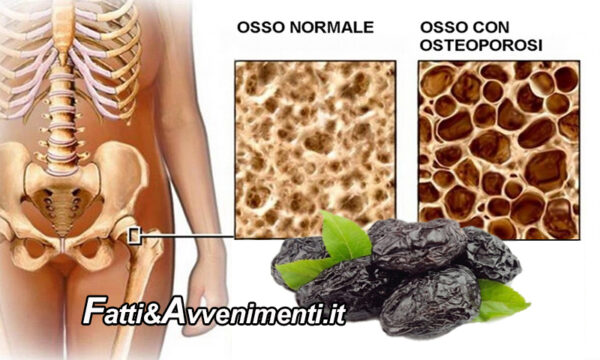Salute & Benessere. Osteoporosi: un aiuto dalle prugne secche?