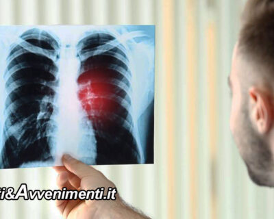 Salute & Benessere. Tumore ai polmoni: arriva un nuovo farmaco che “blocca” la malattia